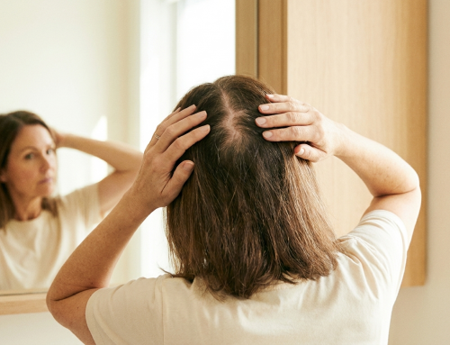 Alopecia femenina: señales, causas y qué soluciones funcionan de verdad
