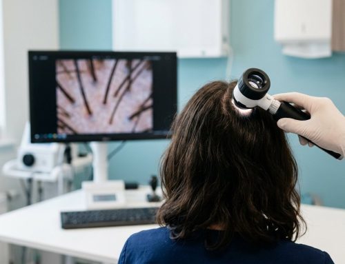 Diagnóstico capilar con IA: qué pueden decirte una app, ChatGPT o la tricoscopia (y qué no)