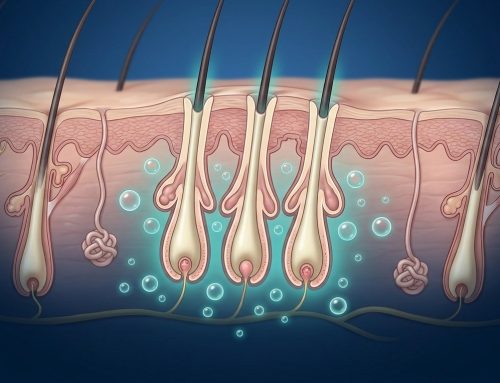 Exosomas y trasplante capilar: qué se sabe de usarlos antes, durante y después del injerto